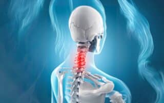 Can You Get Social Security Disability for Neck Pain